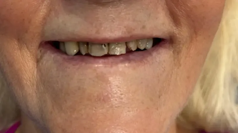 Antes del tratamiento dental