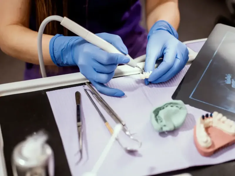 Equipo de ultrasonido Equipo de ultrasonido para diagnóstico dental avanzado